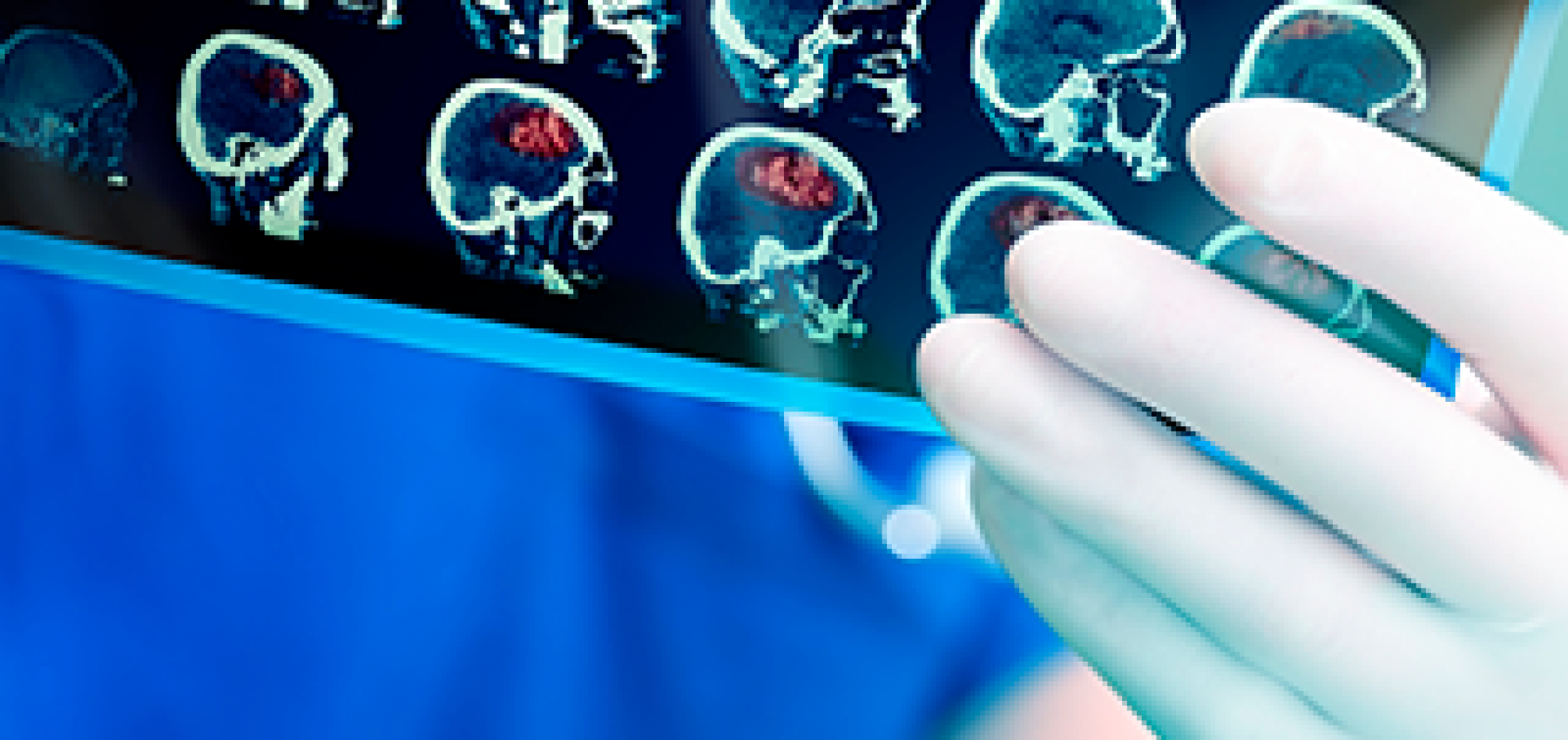 Imagerie Médicale - CHPG